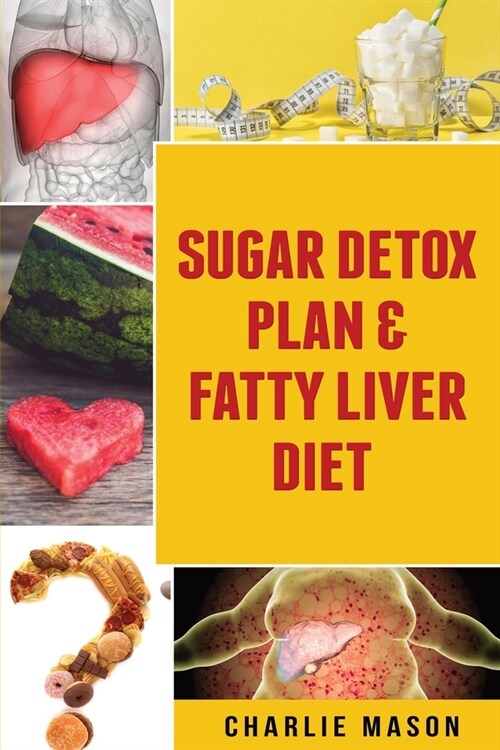 Sugar Detox Plan & Fatty Liver Diet (Paperback)
