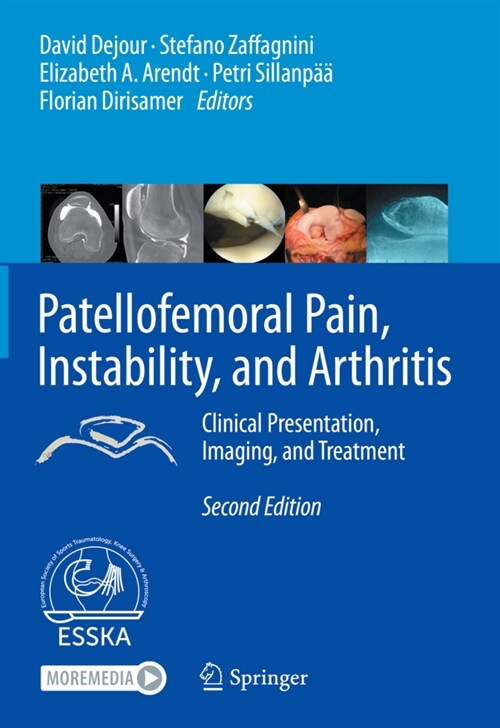 Patellofemoral Pain, Instability, and Arthritis: Clinical Presentation, Imaging, and Treatment (Hardcover, 2, 2020)