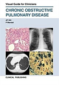 Chronic Obstructive Pulmonary Disease (Hardcover)