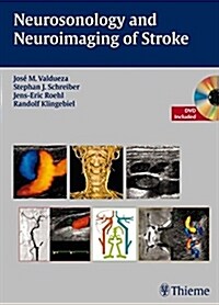 Neurosonology and Neuroimaging of Stroke [With DVD] (Hardcover)