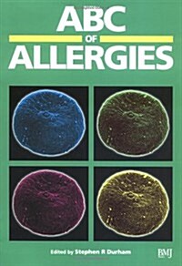 ABC of Allergies (Paperback)