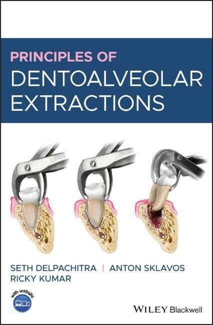 Principles of Dentoalveolar Extractions (Hardcover)