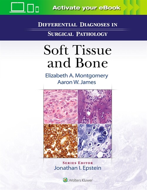 Differential Diagnoses in Surgical Pathology: Soft Tissue and Bone (Hardcover)