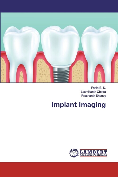 Implant Imaging (Paperback)