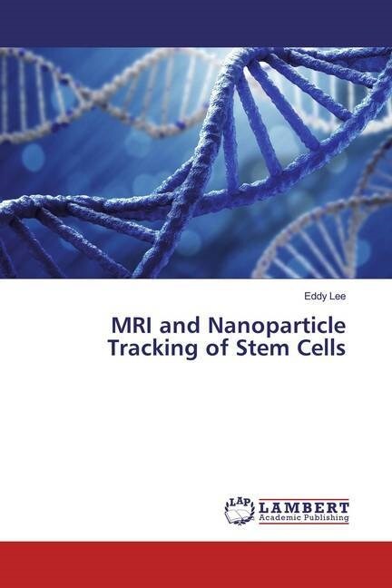 MRI and Nanoparticle Tracking of Stem Cells (Paperback)