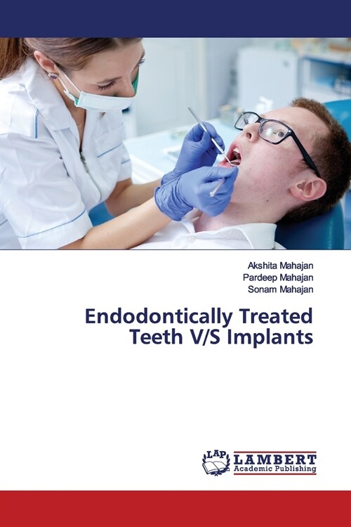 Endodontically Treated Teeth V/S Implants (Paperback)