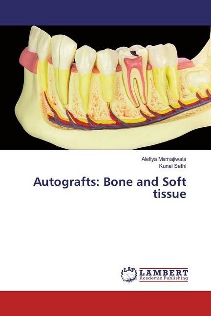 Autografts: Bone and Soft tissue (Paperback)