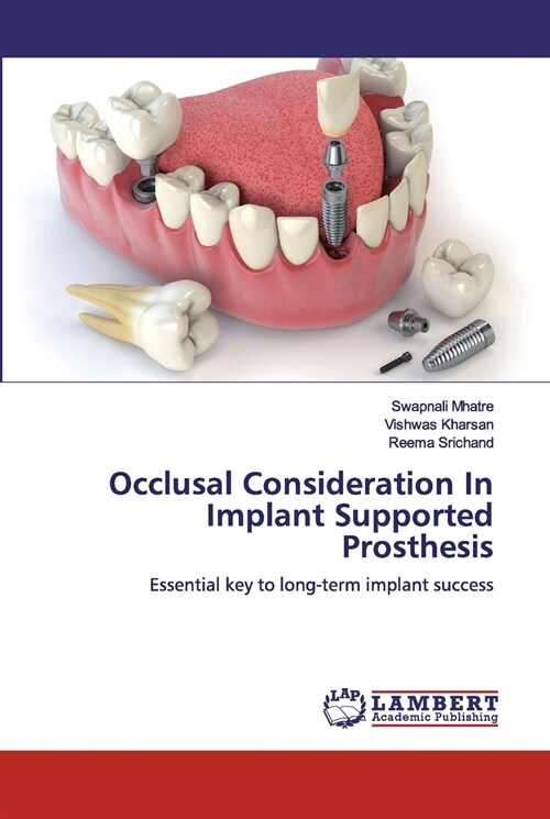Occlusal Consideration In Implant Supported Prosthesis (Paperback)