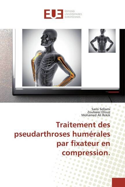 Traitement des pseudarthroses humerales par fixateur en compression. (Paperback)