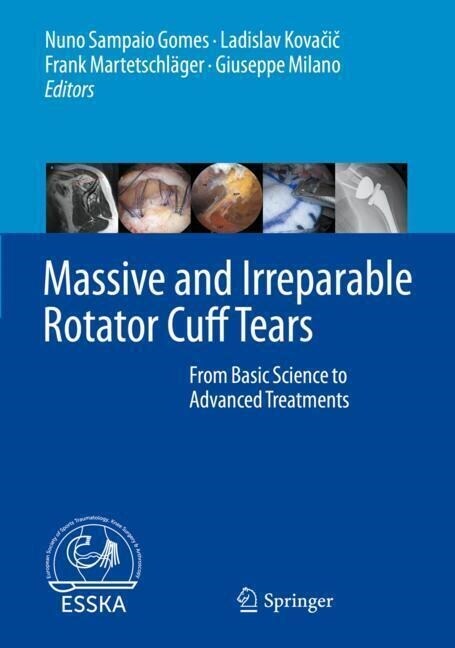 Massive and Irreparable Rotator Cuff Tears: From Basic Science to Advanced Treatments (Hardcover, 2020)