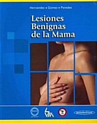 Lesiones benignas de la mama / Benign Breast Lesions (Paperback, 1st)