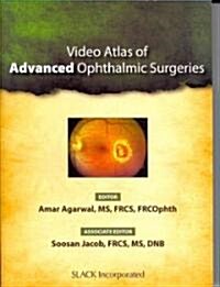 Video Atlas of Advanced Ophthalmic Surgeries (DVD-ROM, 1st)