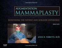 Augmentation mammaplasty : redefining the patient and surgeon experience