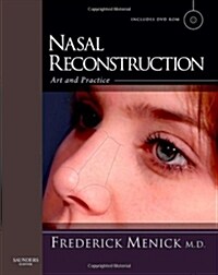Nasal Reconstruction: Art and Practice (Hardcover)
