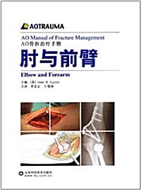 肘與前臂:AO骨折治療手冊 (第1版, 平裝)