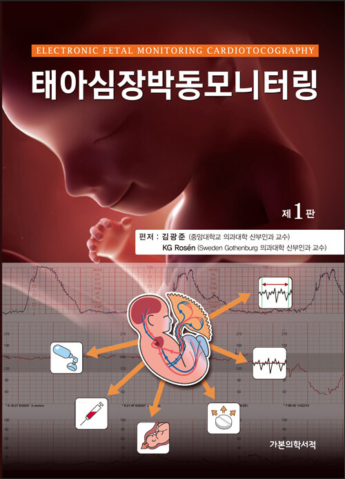 태아심장박동모니터링