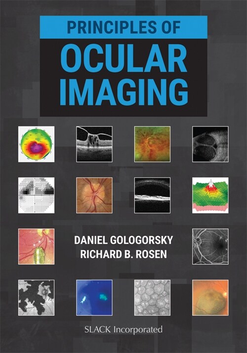 Principles of Ocular Imaging (Hardcover)