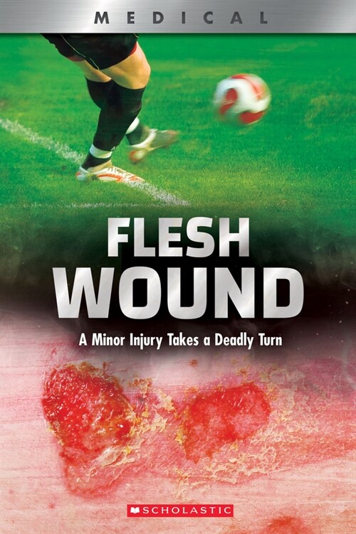 Flesh Wound: A Minor Injury Takes a Deadly Turn (Xbooks) (Hardcover, Library)