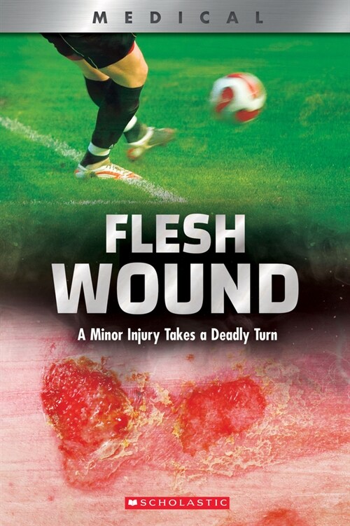 [중고] Flesh Wound: A Minor Injury Takes a Deadly Turn (Xbooks) (Paperback)