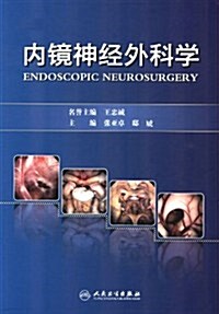 內鏡神經外科學 (第1版, 精裝)