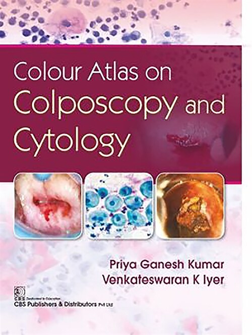 Colour Atlas on Colposcopy and Cytology (Paperback)