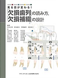 見る目が變わる!  「欠損齒列」の讀み方,「欠損補綴」の設計 (單行本(ソフトカバ-))