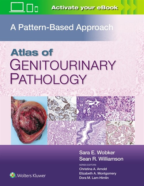 Atlas of Genitourinary Pathology: A Pattern Based Approach (Hardcover)