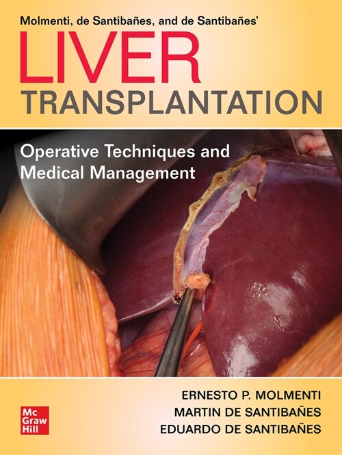 Liver Transplantation: Operative Techniques and Medical Management (Hardcover)