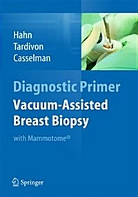 Vacuum-Assisted Breast Biopsy with Mammotome(r) (Paperback, 2013)