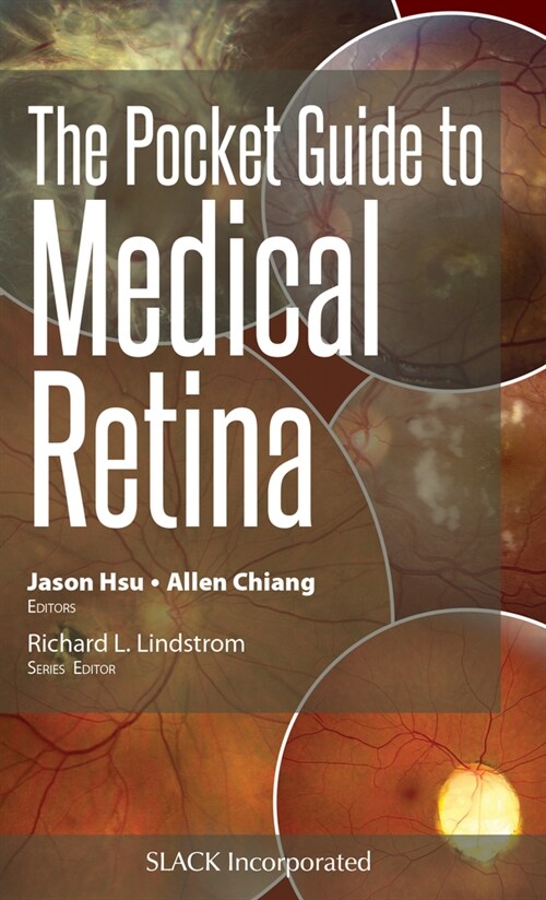 The Pocket Guide to Medical Retina (Paperback)