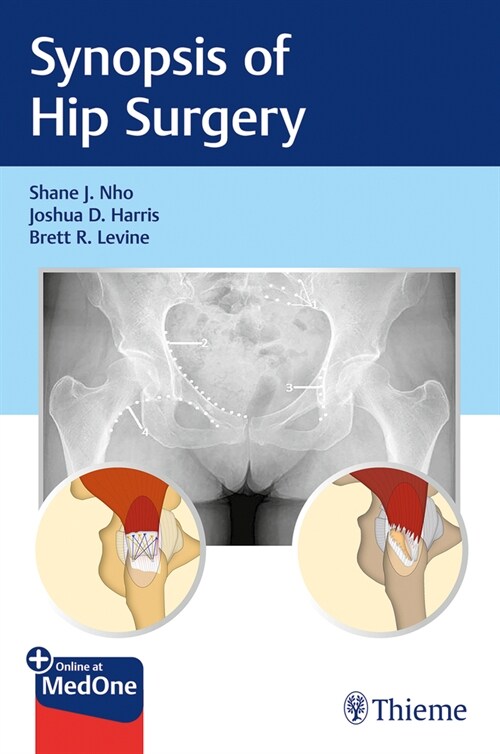 Synopsis of Hip Surgery (Paperback)