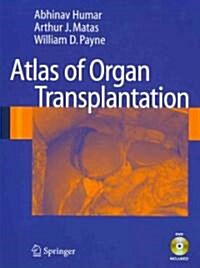 Atlas of Organ Transplantation (Paperback, 1st ed. 2006. 2nd printing 2008)