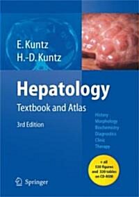 Hepatology: Textbook and Atlas (Hardcover, 3, 2008)