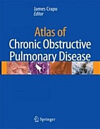Atlas of Chronic Obstructive Pulmonary Disease (Hardcover, 2009)