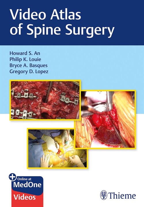 Video Atlas of Spine Surgery (Hardcover)