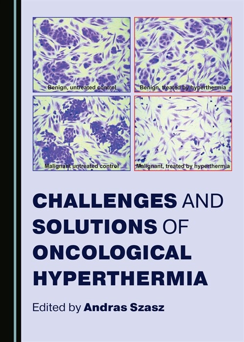 Challenges and Solutions of Oncological Hyperthermia (Hardcover)
