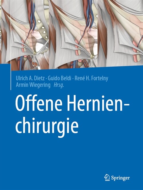 Offene Hernienchirurgie (Hardcover)