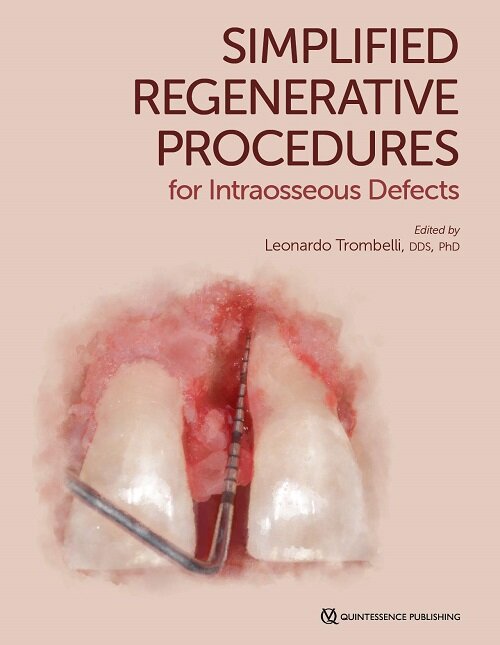 Simplified Regenerative Procedures for Intraosseous Defects (Hardcover)
