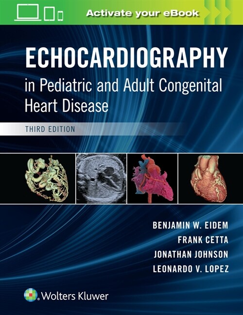 Echocardiography in Pediatric and Adult Congenital Heart Disease (Hardcover, 3)