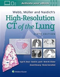 Webb, Müller and Naidich's high-resolution CT of the lung / 6th ed