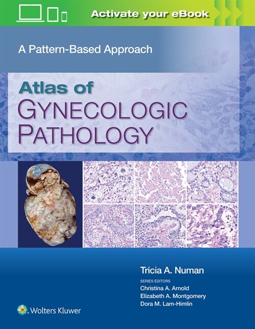 Atlas of Gynecologic Pathology: A Pattern-Based Approach (Hardcover)