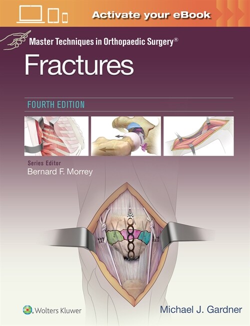 Master Techniques in Orthopaedic Surgery: Fractures (Hardcover, 4)