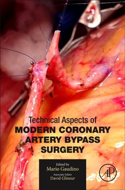 Technical Aspects of Modern Coronary Artery Bypass Surgery (Paperback)