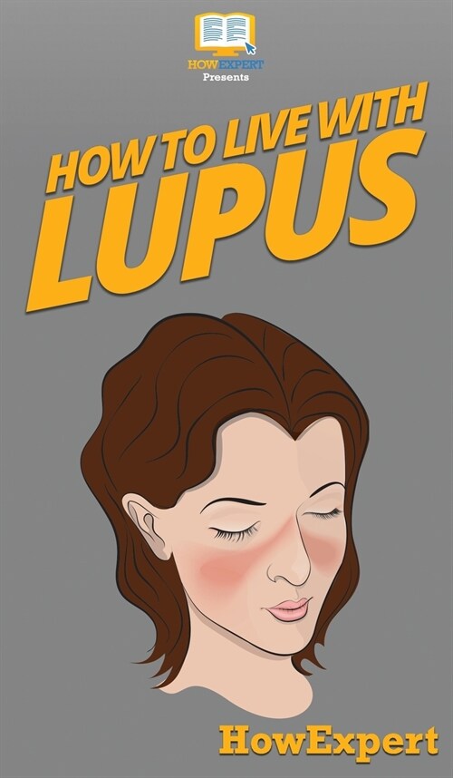 How To Live With Lupus: Your Step By Step Guide To Living With Lupus (Hardcover)