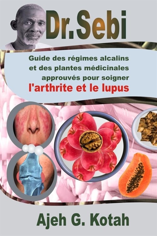 Dr. Sebi: Guide des r?imes alcalins et des plantes m?icinales approuv? pour soigner larthrite et le lupus (Paperback)