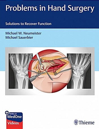 Problems in Hand Surgery: Solutions to Recover Function (Hardcover)