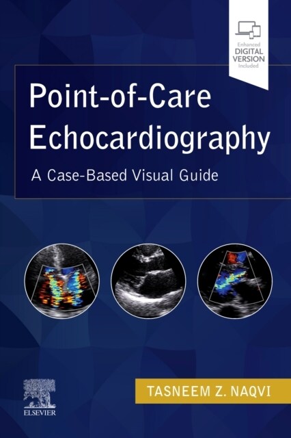 Point-Of-Care Echocardiography: A Clinical Case-Based Visual Guide (Paperback)