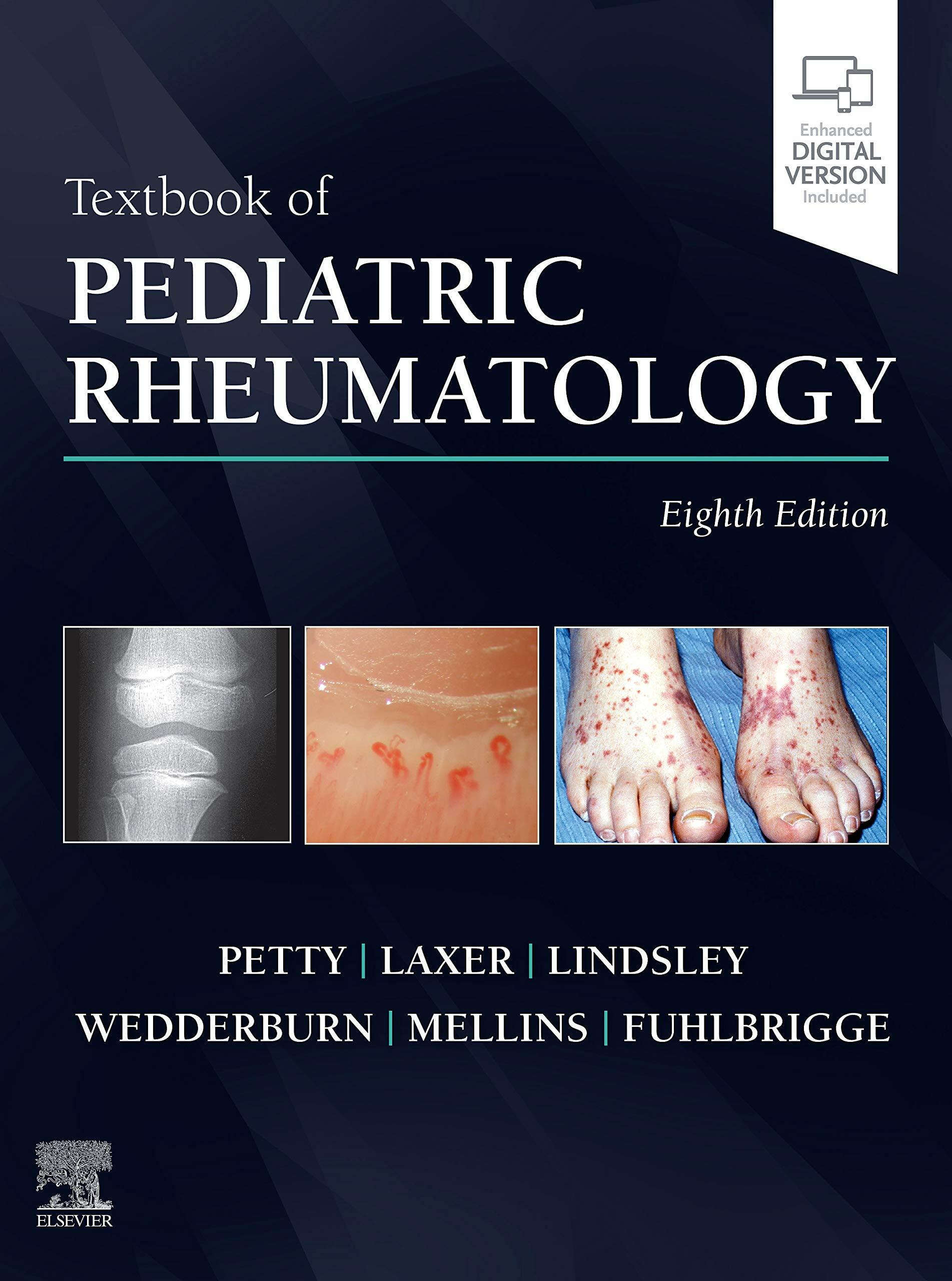 Textbook of Pediatric Rheumatology (Hardcover, 8)