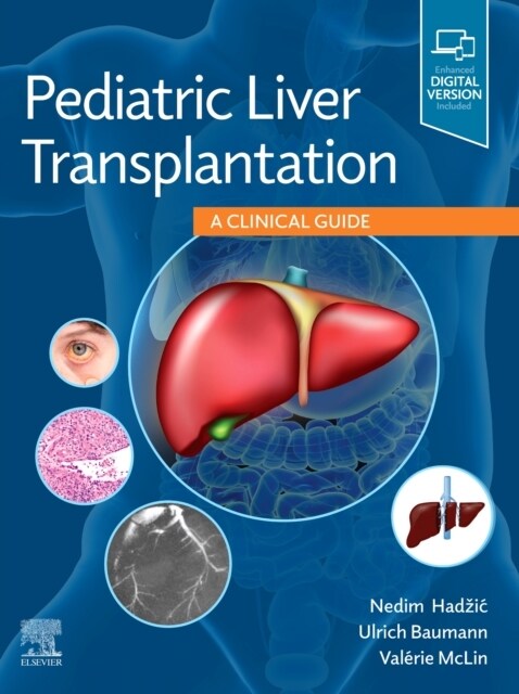 Pediatric Liver Transplantation: A Clinical Guide (Hardcover)