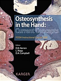Osteosynthesis in the Hand: Current Concepts (Hardcover)
